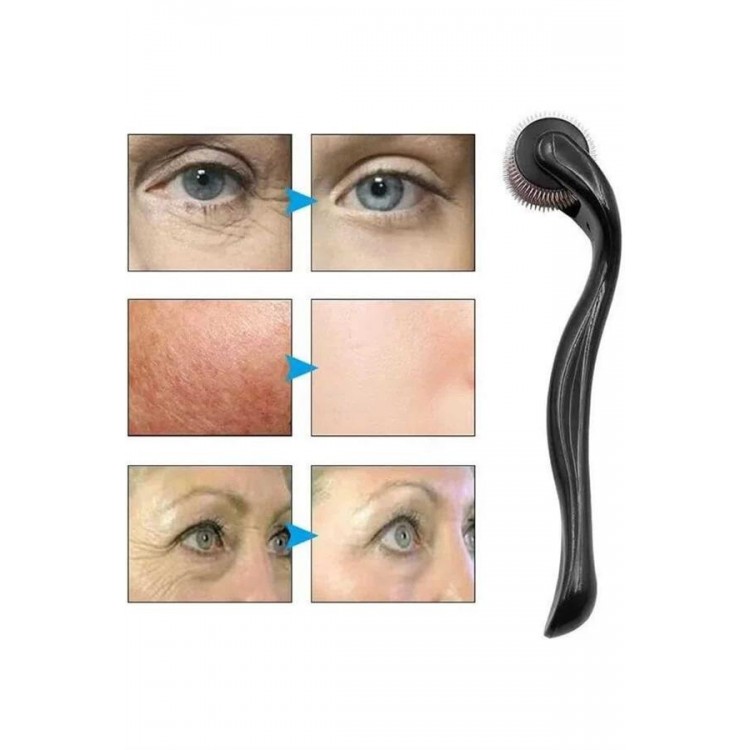 Dermaroller Titanyum 540 Iğneli 1 Mm Saç Kaş Sakal Serum Kullanıma Uygun