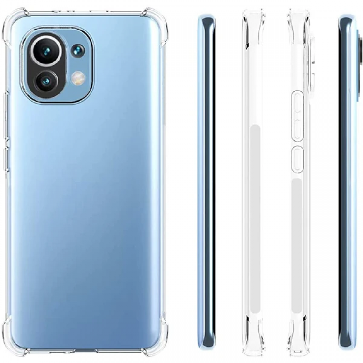 Xiaomi Mi 11 Kamera Korumalı Shockproof Darbe Emici Silikon Kılıf-(5775)
