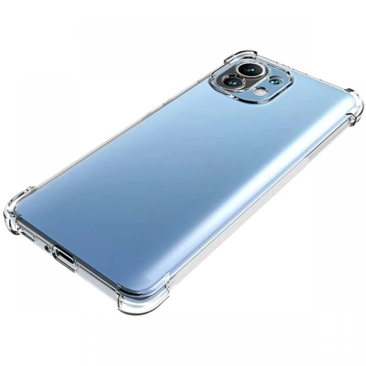 Xiaomi Mi 11 Lite Kamera Korumalı Shockproof Şeffaf Silikon Kılıf-(5775)